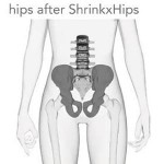 ShrinkX - Hips Ultra (After Baby) - Size M/L - UpSpring Baby - BabyOnline HK